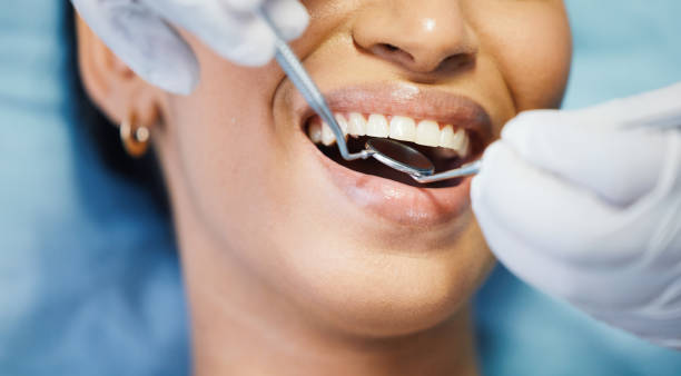 Best Emergency Dentist for Lost Fillings or Crowns in Linntown, PA
